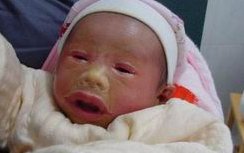 试管婴儿质量优于数量，基础卵泡数多不代表妊娠率就高