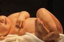 大夫说不建议抽血做abo溶血的原因是什么？